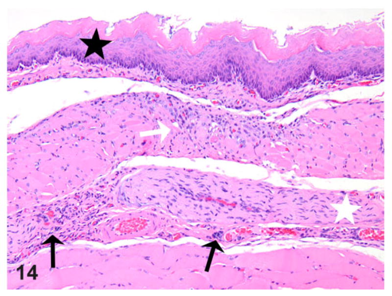 Figure 14