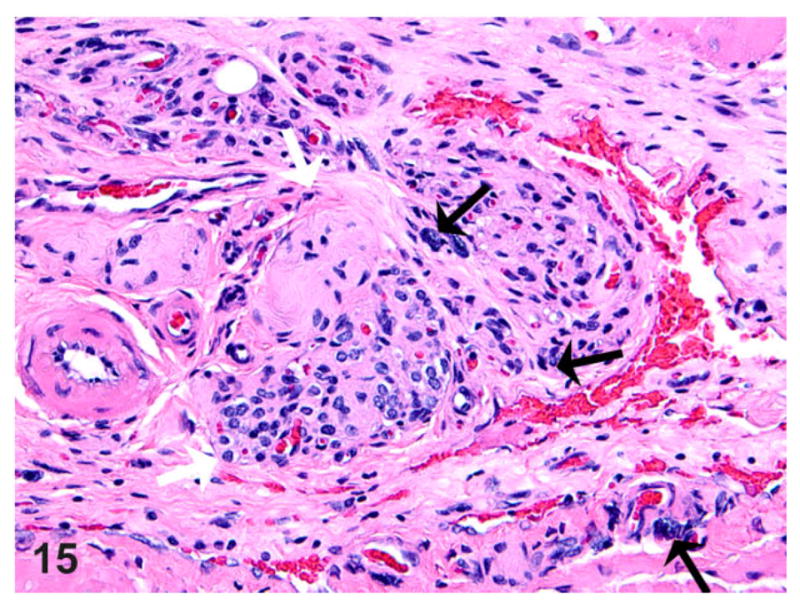 Figure 15