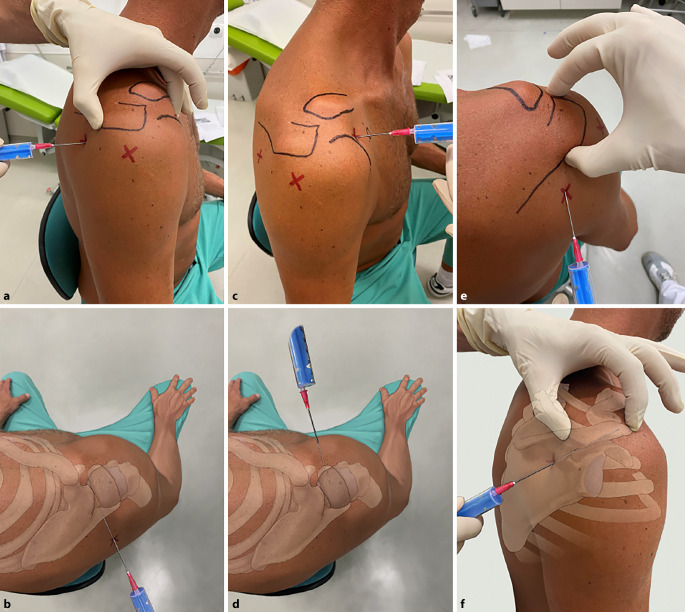 graphic file with name 64_2022_786_Fig4_HTML.jpg