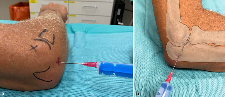 graphic file with name 64_2022_786_Fig5_HTML.jpg