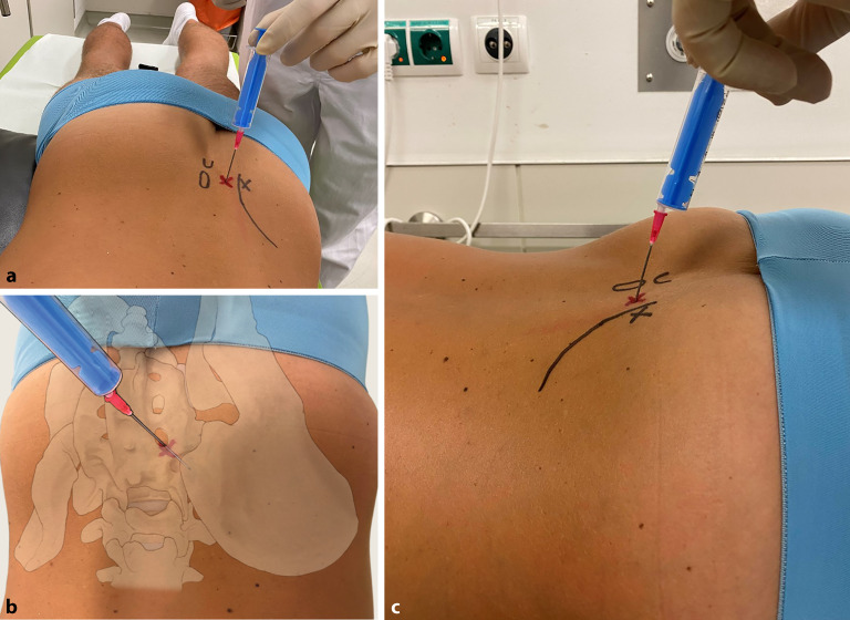 graphic file with name 64_2022_786_Fig7_HTML.jpg