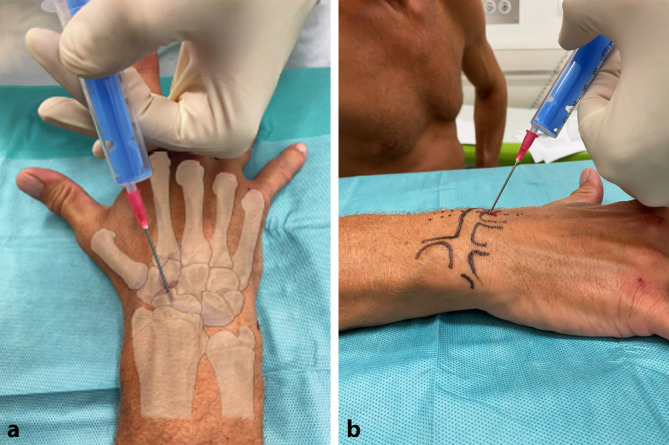 graphic file with name 64_2022_786_Fig6_HTML.jpg