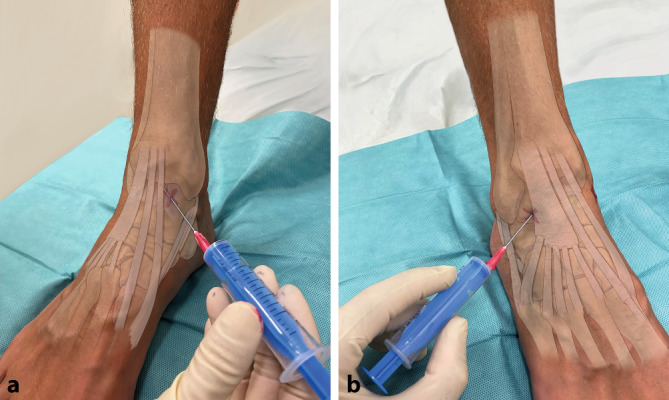 graphic file with name 64_2022_786_Fig10_HTML.jpg