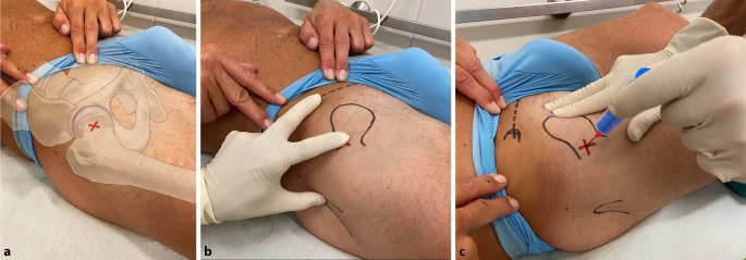 graphic file with name 64_2022_786_Fig8_HTML.jpg