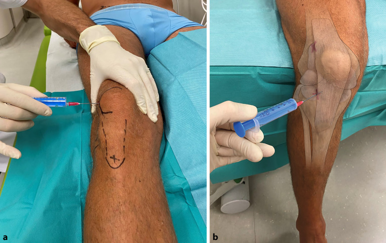 graphic file with name 64_2022_786_Fig9_HTML.jpg