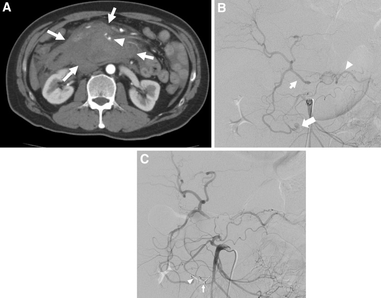 Fig. 9