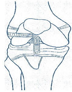 Fig. (6)