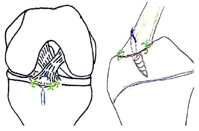 Fig. (8)