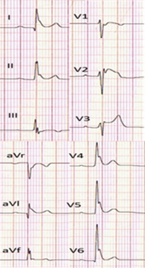 Figure 5