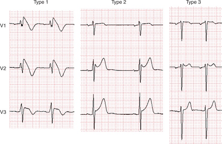 Figure 1