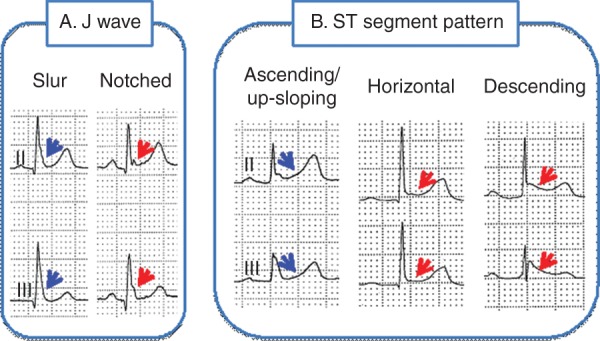 Figure 3