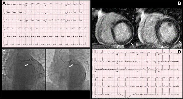 Figure 1