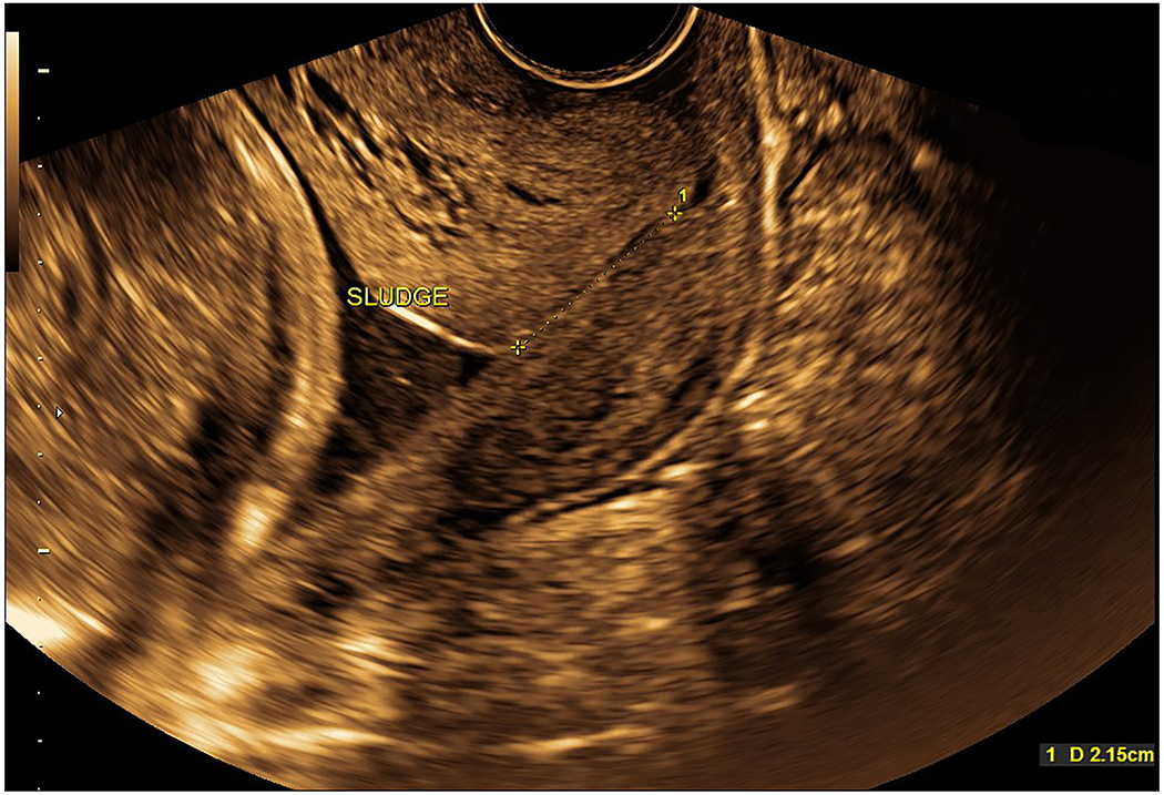 Figure 4: