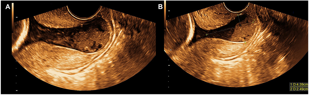 Figure 3 (A and B):