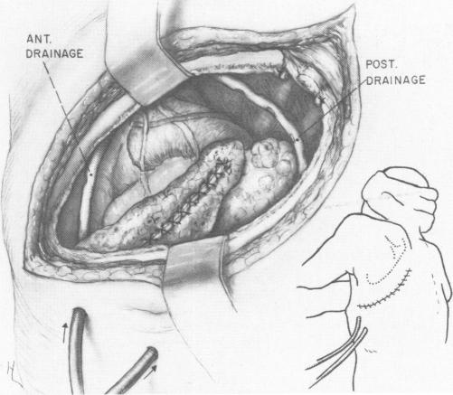 Fig. 11.