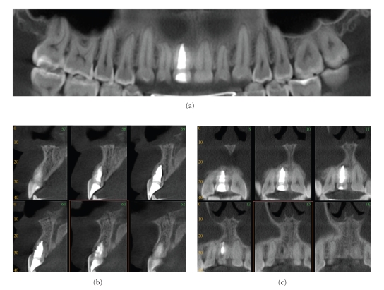 Figure 15