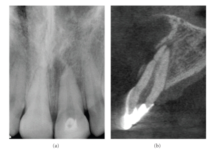 Figure 13