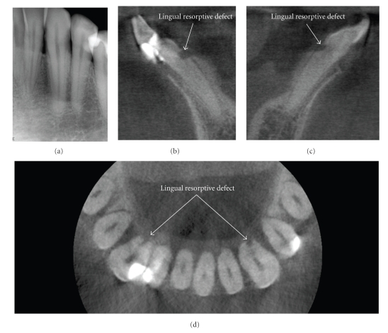 Figure 14