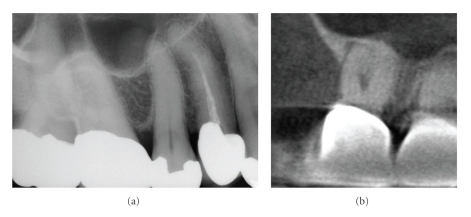 Figure 12