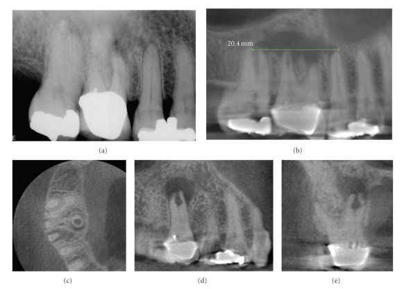 Figure 16