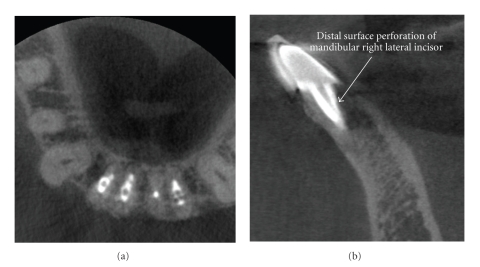 Figure 17