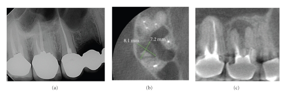 Figure 11