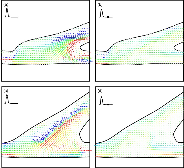 Fig 11