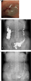 Fig. 2