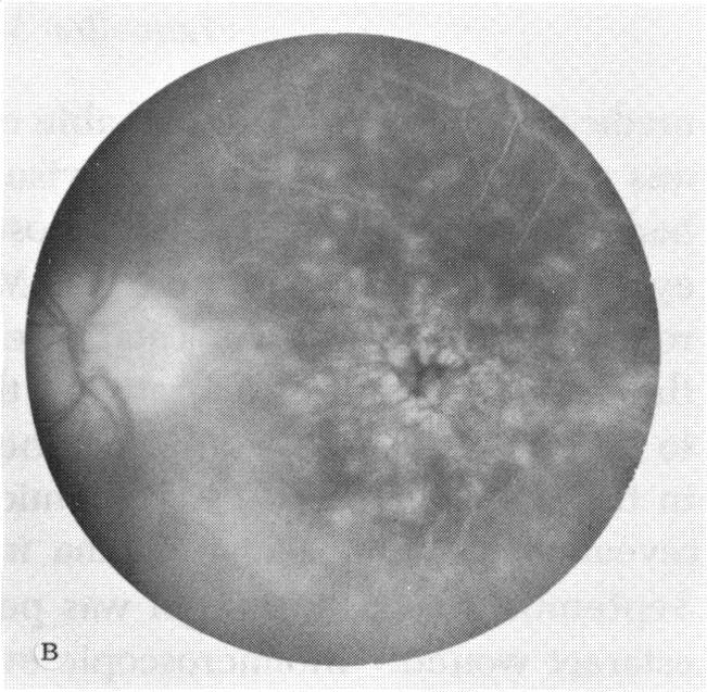 FIGURE 2 B