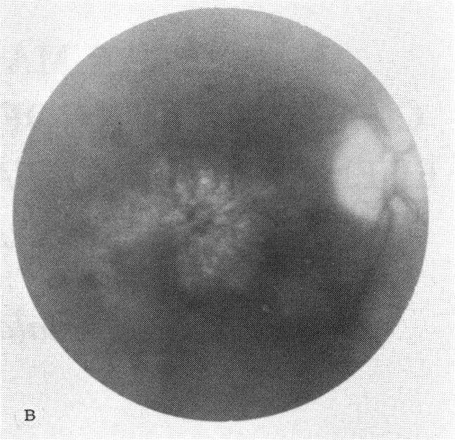 FIGURE 1 B