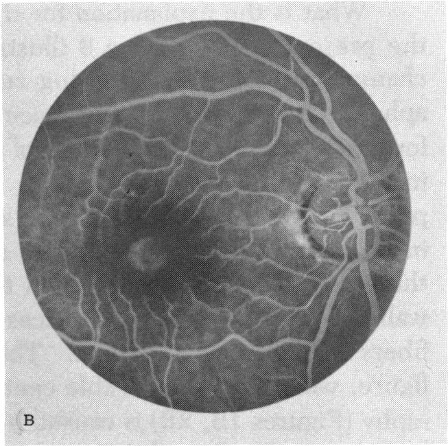 FIGURE 10 B