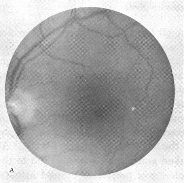 FIGURE 2 A