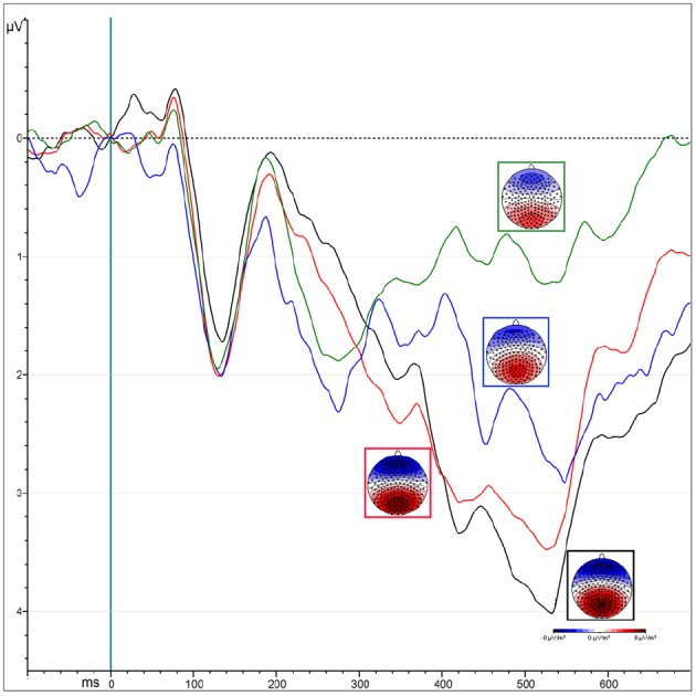 FIGURE 4
