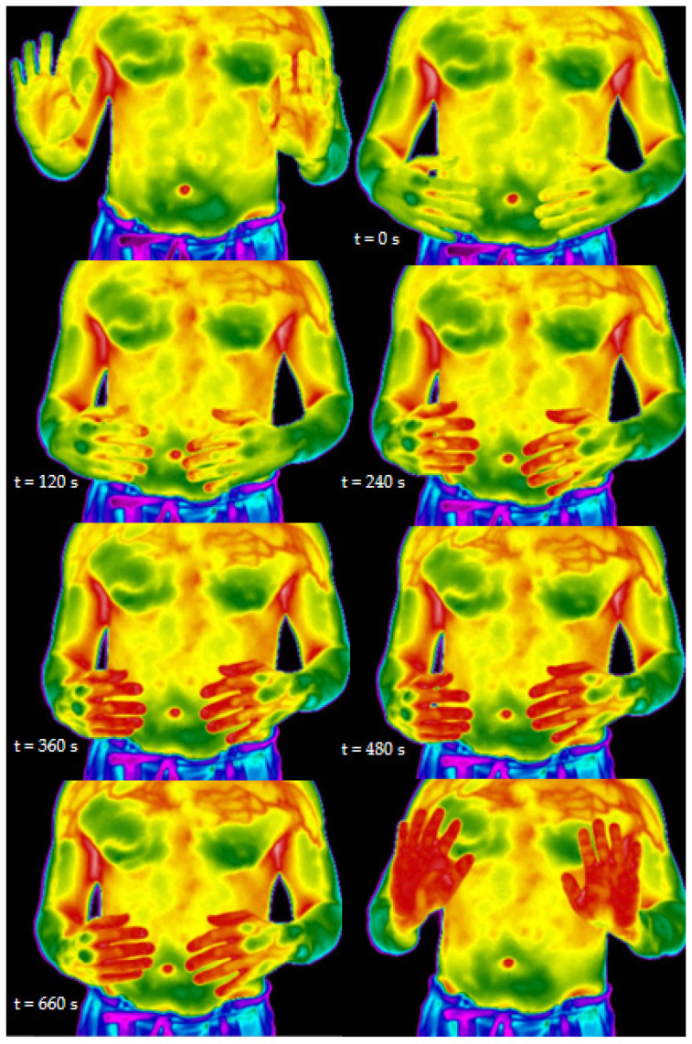 Figure 11