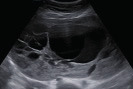 graphic file with name FVVinObGyn-13-107-tg022.jpg