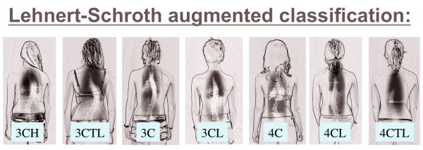 Figure 26