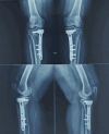 Figure 17