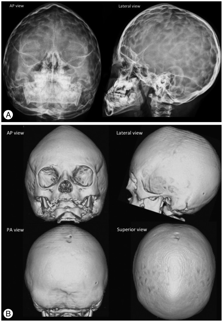 Fig. 9