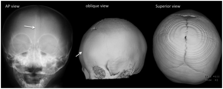 Fig. 7