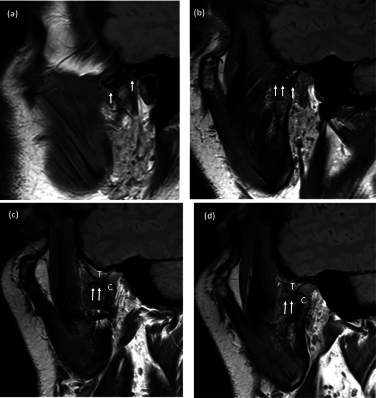 Fig 3: