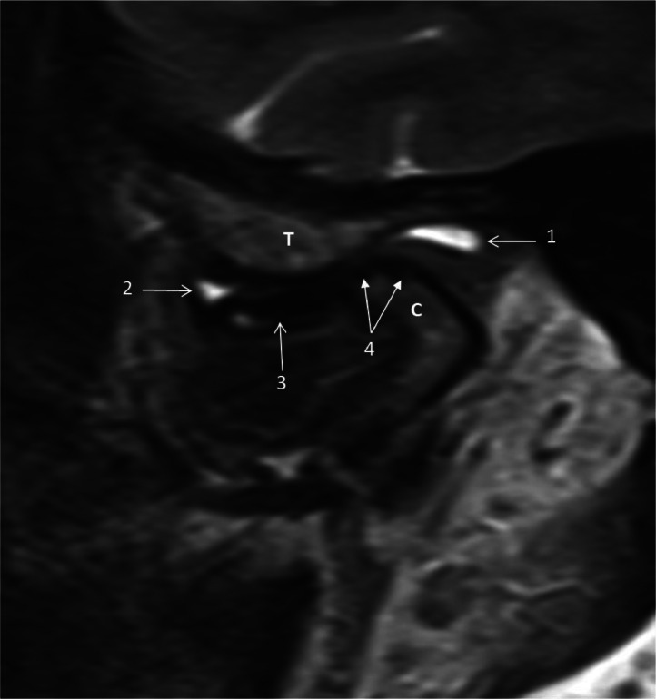 Fig 2: