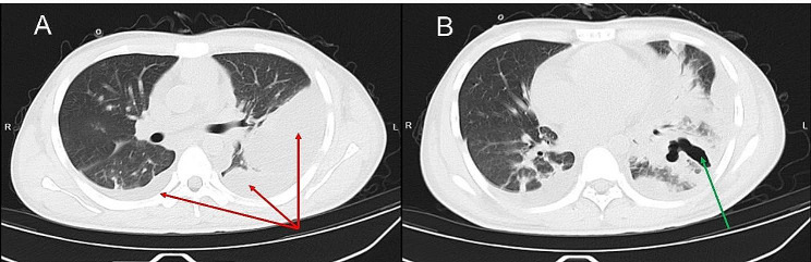 Fig. 2