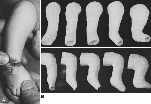 Fig. 4A–B