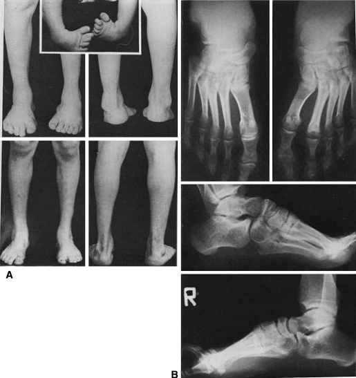 Fig. 5A–B