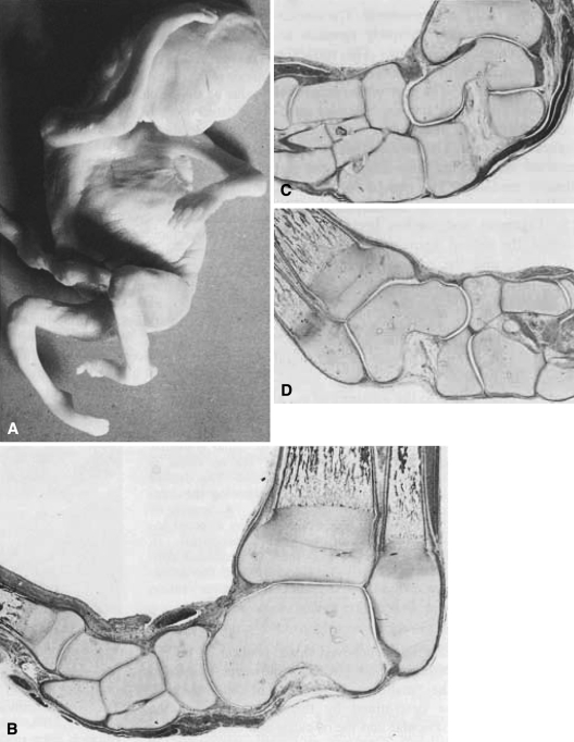 Fig. 1A–D