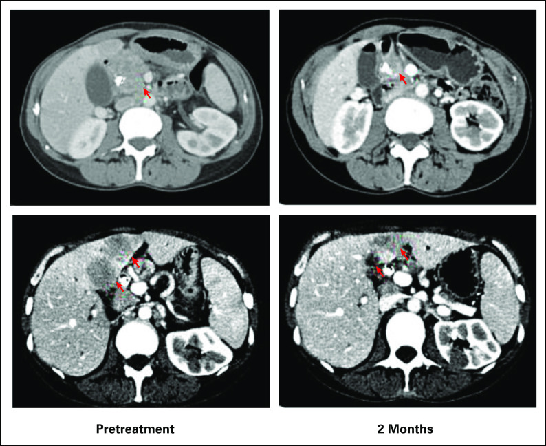 FIG 5.