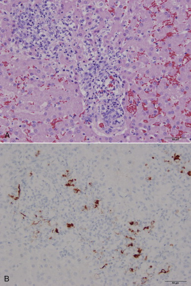 FIGURE 20-11