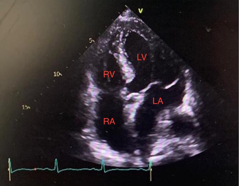 Figure 4