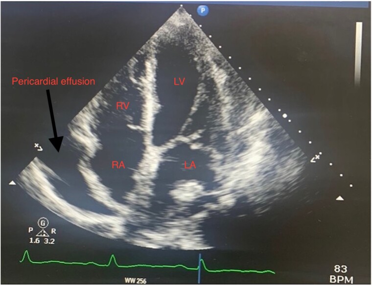 Figure 2