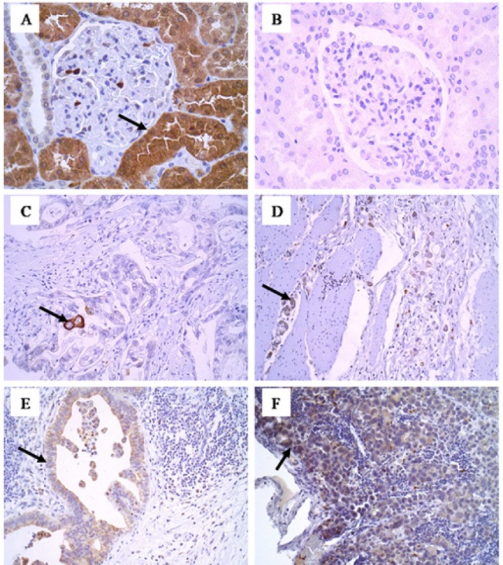 Figure1